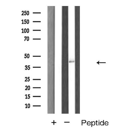 CTSE / Cathepsin E Antibody