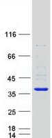 Human SULT1B1 / Sulfotransferase 1B1 Protein (Recombinant Myc-DDK (Flag))