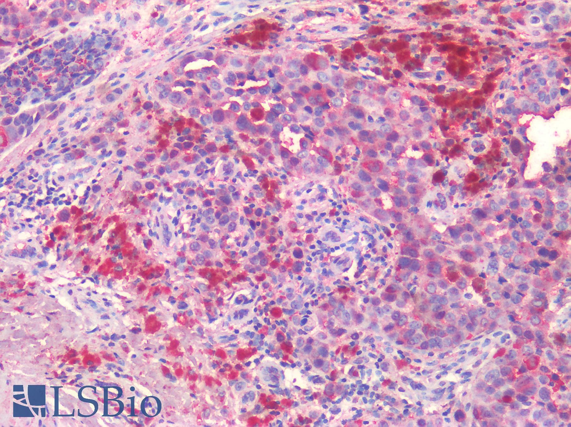 PathPlus™ EPHB2 / EPH Receptor B2 Antibody (Internal)