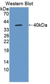 IL22RA1 / IL22R Antibody (aa258-552, Cy3)