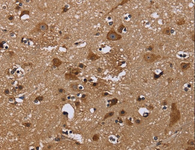 Polyclonal Rabbit anti-Human NCSTN / Nicastrin Antibody (IHC)