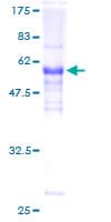 Human LDB3 / ZASP Protein (Recombinant GST)
