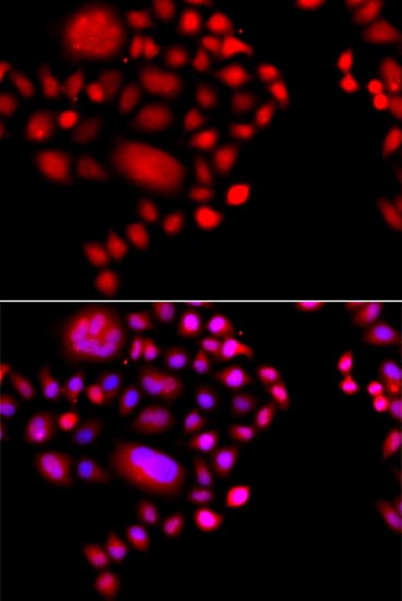 Polyclonal Rabbit anti-Human POLR1D Antibody (IF, WB)