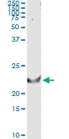 TNFSF14 / LIGHT Antibody (clone 4E3)