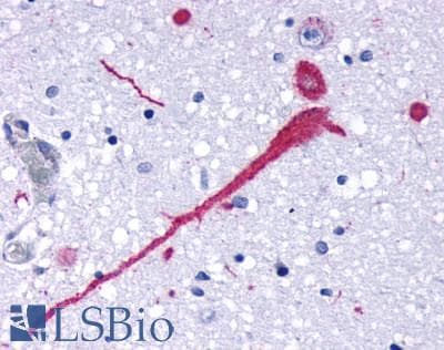 PathPlus™ CCR7 Antibody (C-Terminus)