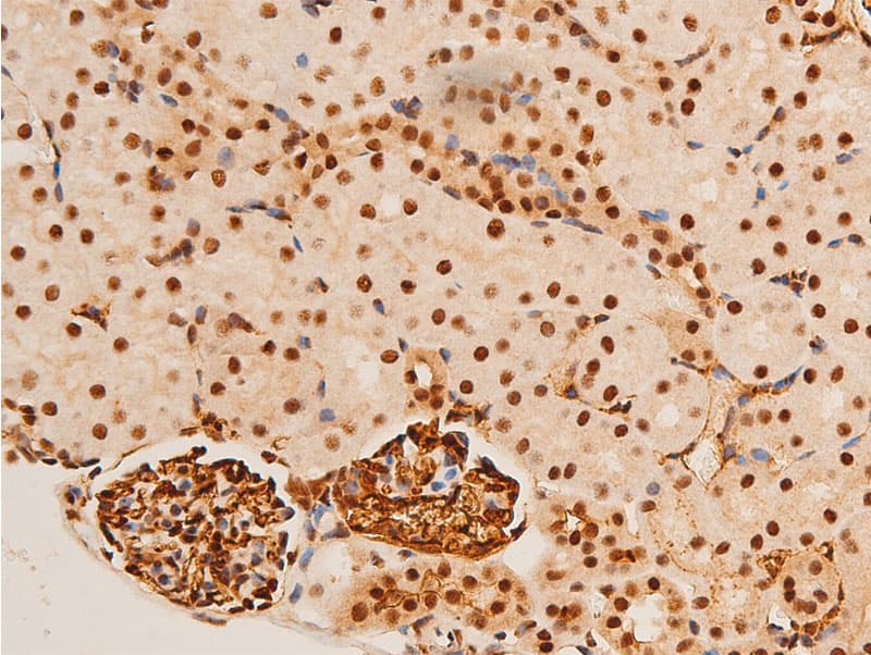 Polyclonal Rabbit anti-Human JUN / c-Jun Antibody (phospho-Thr91, IHC, WB)