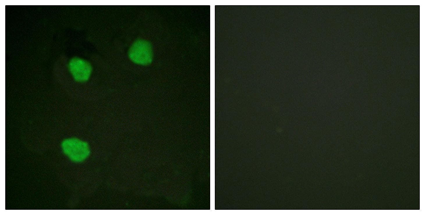 CENPA / CENP-A Antibody (Ab-7)