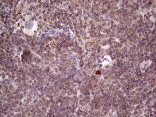 PKD3 / PRKD3 Antibody (aa300-508, clone OTI3D8)
