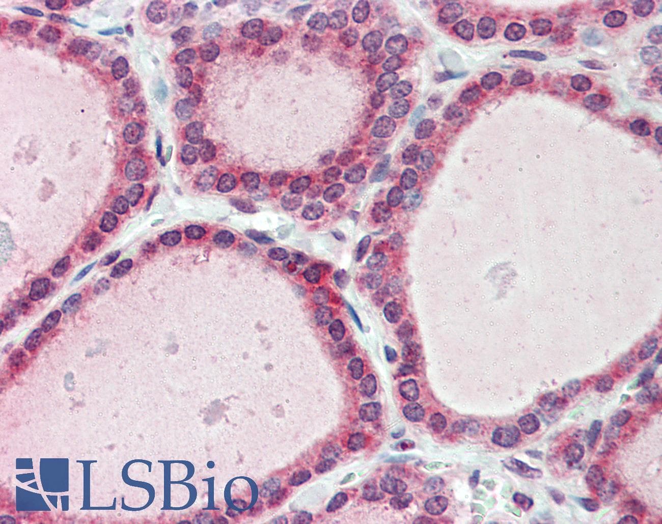 IHC-plus™ Polyclonal Rabbit anti-Human ESYT1 Antibody (Internal, IHC)