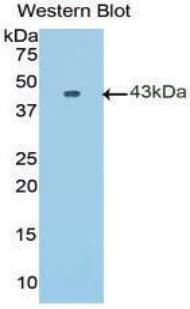 KRT7 / CK7 / Cytokeratin 7 Antibody (aa91-394)