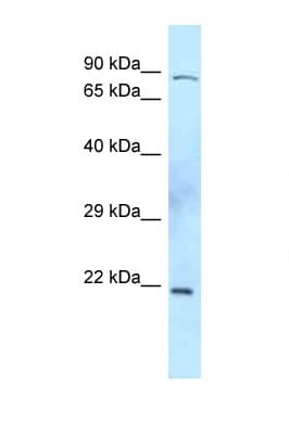 TIMP2 Antibody (C-Terminus)