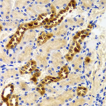 IHC-plus™ HIWI2 / PIWIL4 Antibody