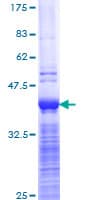 Human ABCC2 / MRP2 Protein (Recombinant GST, N-terminus)