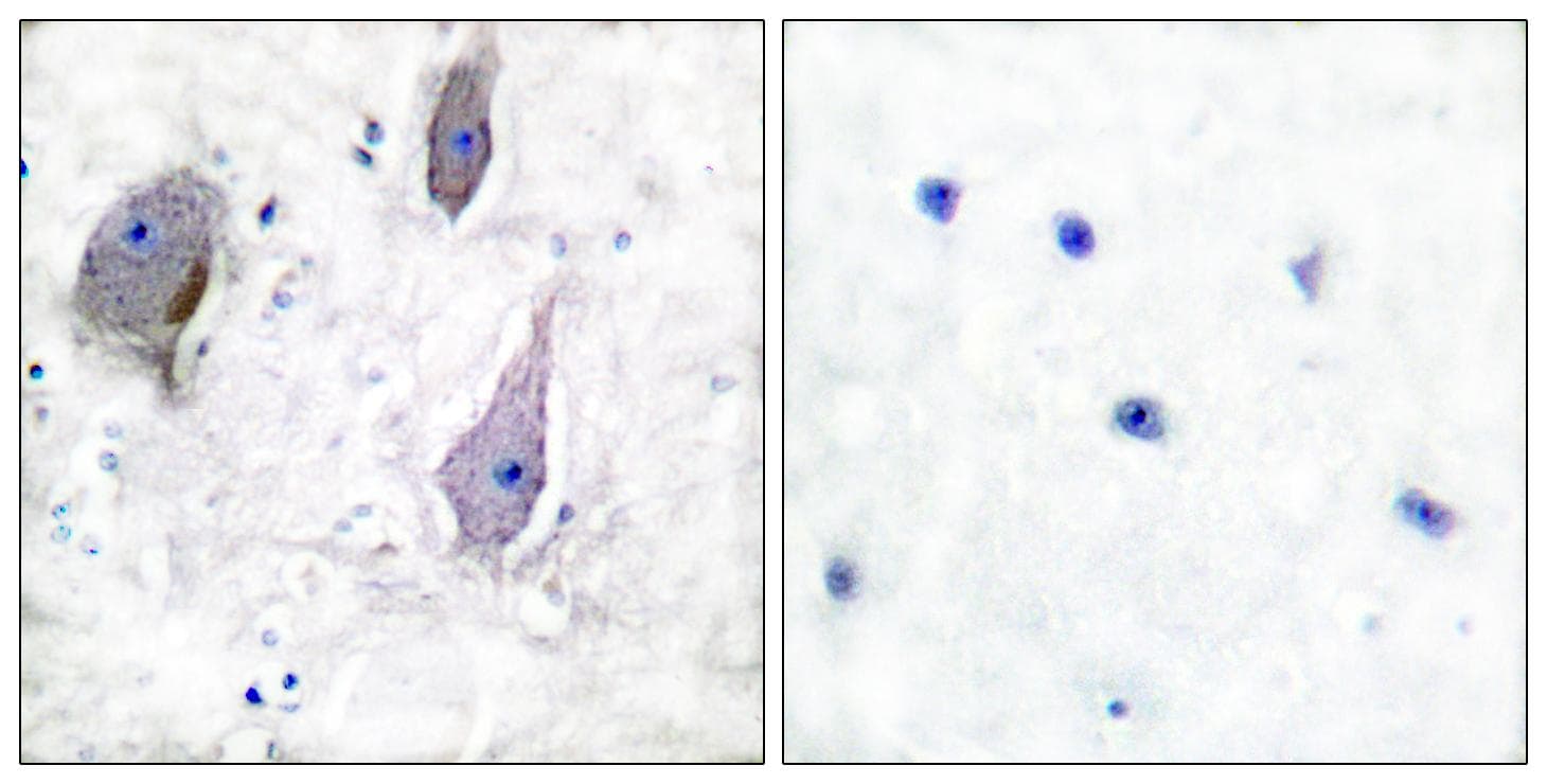 PMP22 Antibody