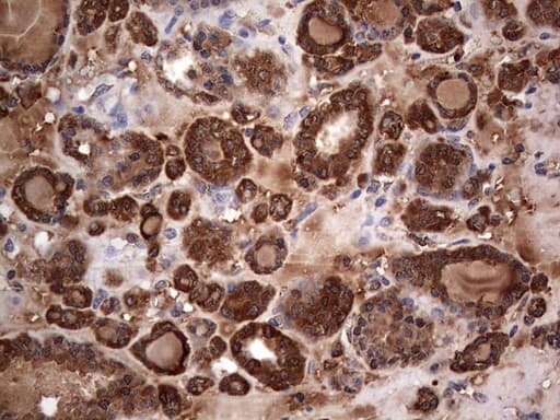 MTDH / Metadherin Antibody (aa70-582, clone OTI2F11)