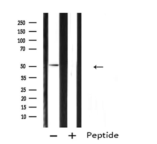 Polyclonal Rabbit anti-Human ARX Antibody (IF, WB)