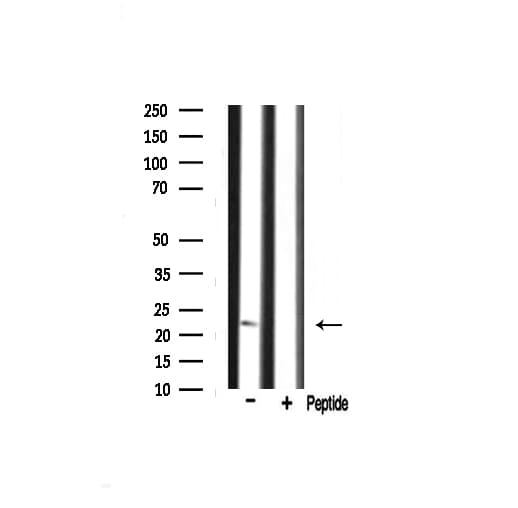 Polyclonal Rabbit anti-Human RPS9 / Ribosomal Protein S9 Antibody (IF, WB)