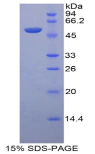Mouse LRG1 / LRG Protein (Recombinant His-GST)