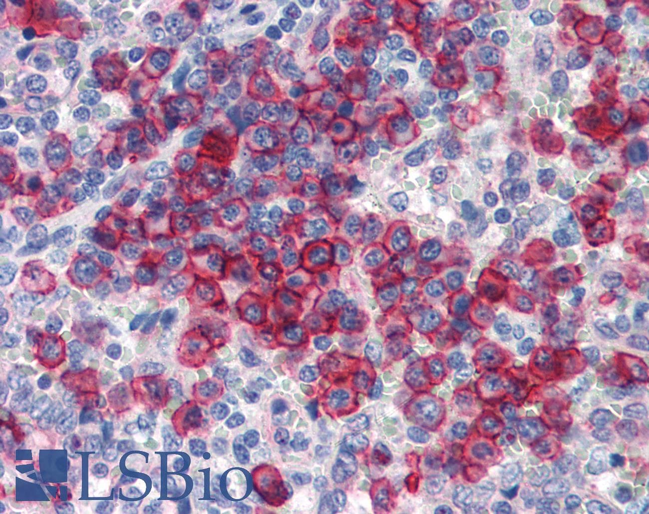 Polyclonal Rabbit anti-Human NCOA3 / SRC-3 / AIB1 Antibody (aa576-625, IHC, WB)