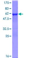 Human TIGAR Protein (Recombinant GST)