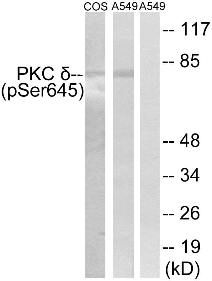 Polyclonal Rabbit anti-Human PRKCD / PKC-Delta Antibody (phospho-Ser645, IHC, WB)