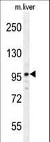 ICE2 / NARG2 Antibody (aa26-54)