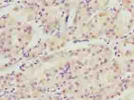 WDR34 Antibody