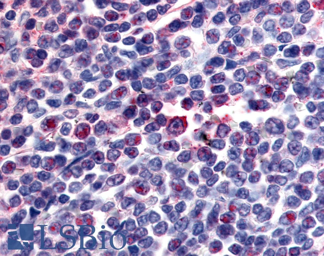 IHC-plus™ ATRN / Attractin Antibody (Internal)