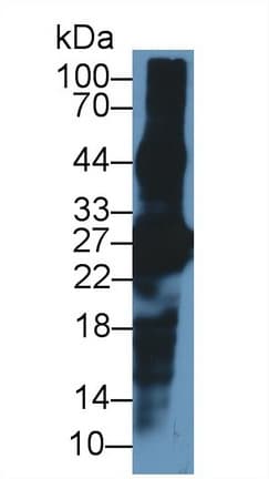 CRYBA1 Antibody (aa1-215, HRP)