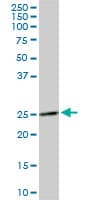 DCUN1D1 / SCCRO Antibody (clone 4B5)