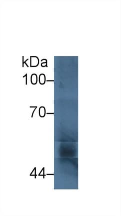 P450SCC / CYP11A1 Antibody (aa391-515)