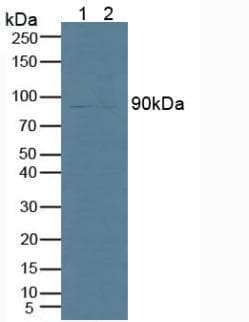 PLA2G6 / IPLA2 Antibody (aa484-701)