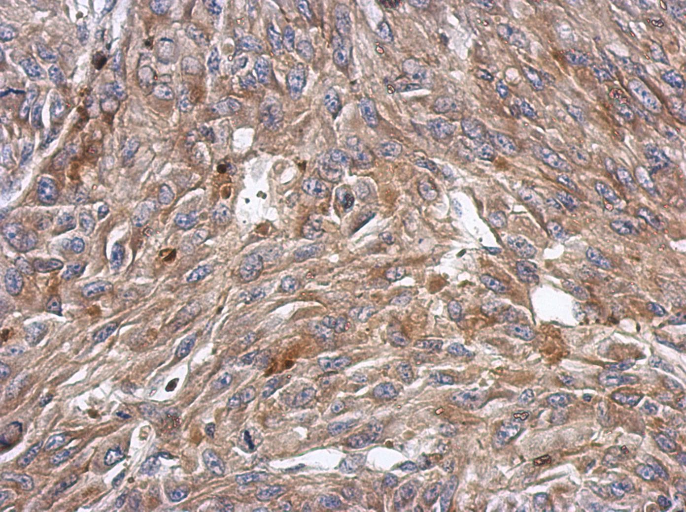 KCTD4 Antibody