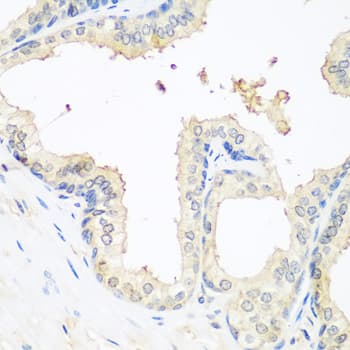 Polyclonal Rabbit anti-Human MMP14 Antibody (IHC, WB)