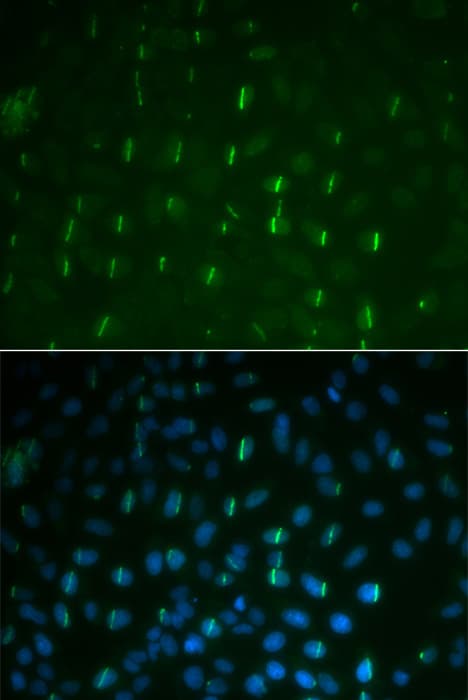 Histone H2A.X Antibody (phospho-Ser139)