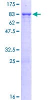 Human PPP2R5C Protein (Recombinant GST)