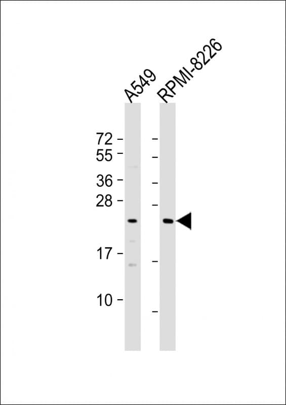 NT5M Antibody (Internal)