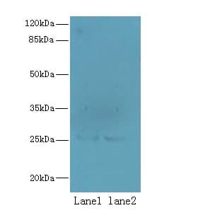 NDFIP1 / N4WBP5 Antibody
