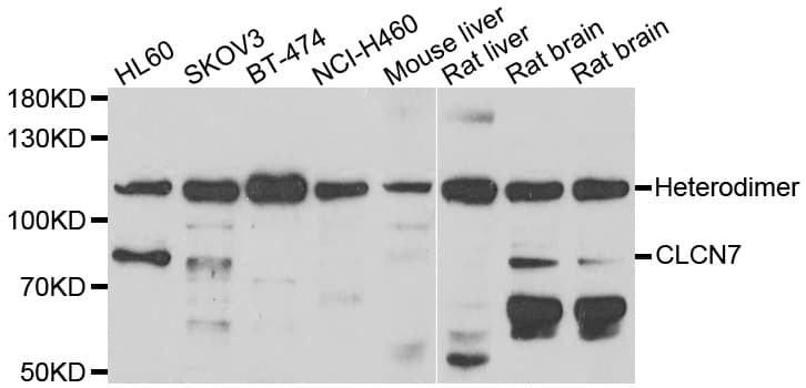 Polyclonal Rabbit anti-Human CLC-7 / CLCN7 Antibody (IHC, WB)