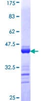 Human TJP2 / ZO2 / ZO-2 Protein (Recombinant GST, N-terminus)