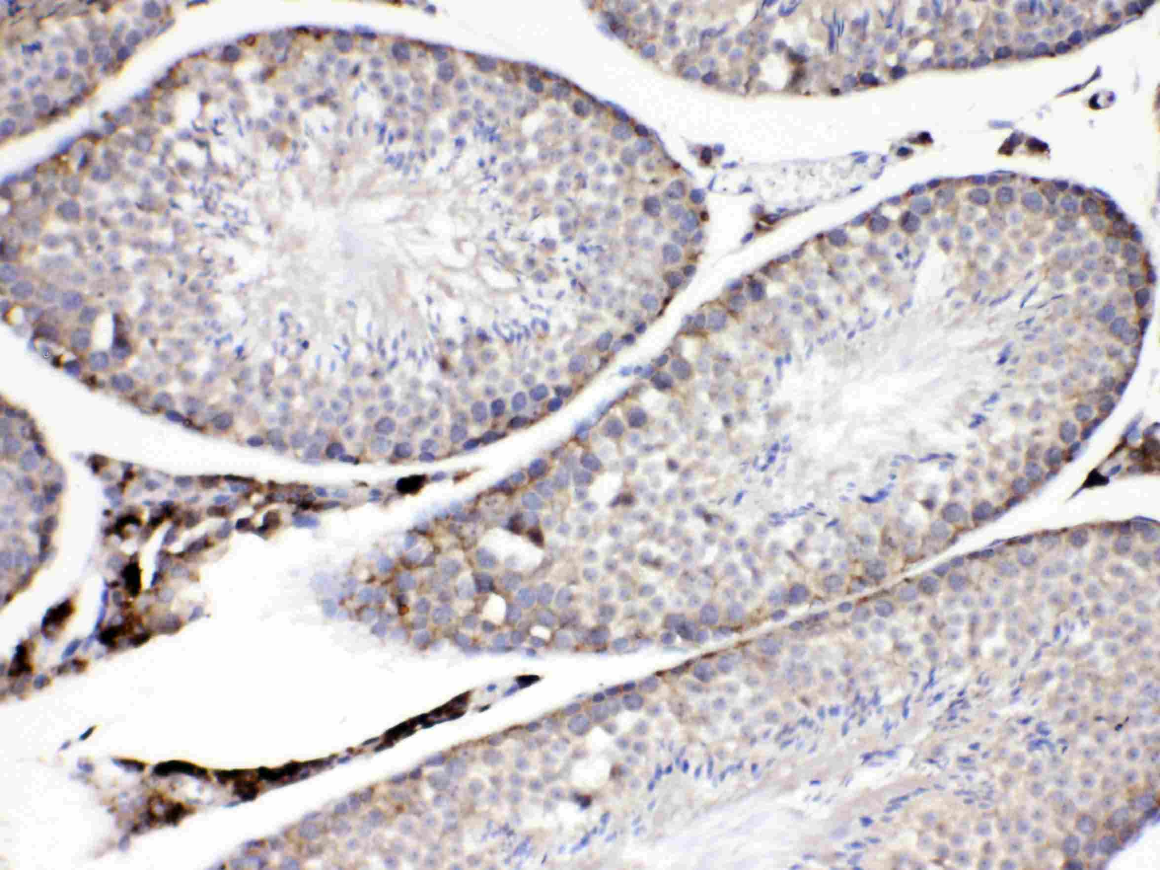 PLIN2 / ADFP / Adipophilin Antibody