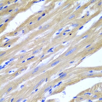 HSPB2 / HSP27 Antibody