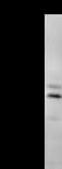 CCNT2 / Cyclin T2 Antibody (clone 2128C1a)