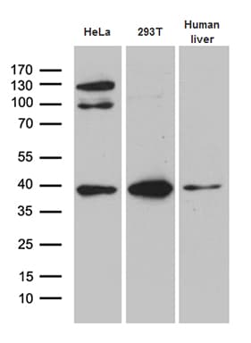 Monoclonal Mouse anti-Human TOMM40 / TOM40 Antibody (clone OTI9A3, IHC, WB)