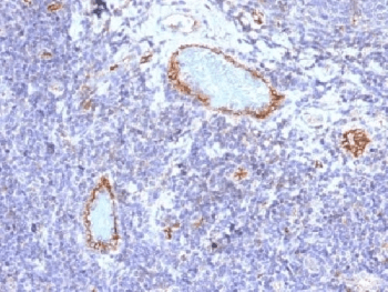VWF / Von Willebrand Factor Antibody (clone VWF/1465)