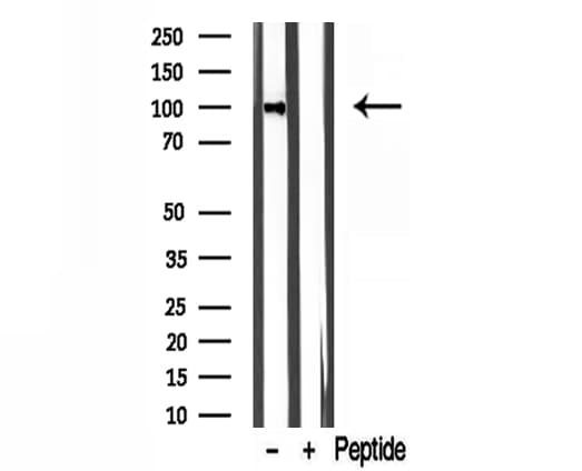 Polyclonal Rabbit anti-Human LONP1 / LON Antibody (IHC, IF, WB)