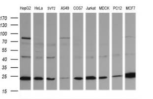 RAB21 Antibody (clone OTI6F11)