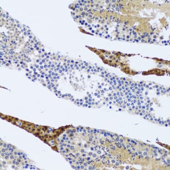 Polyclonal Rabbit anti-Human FMOD / Fibromodulin Antibody (IHC, WB)