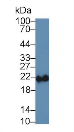 FTH1 / Ferritin Heavy Chain Antibody (aa1-181)