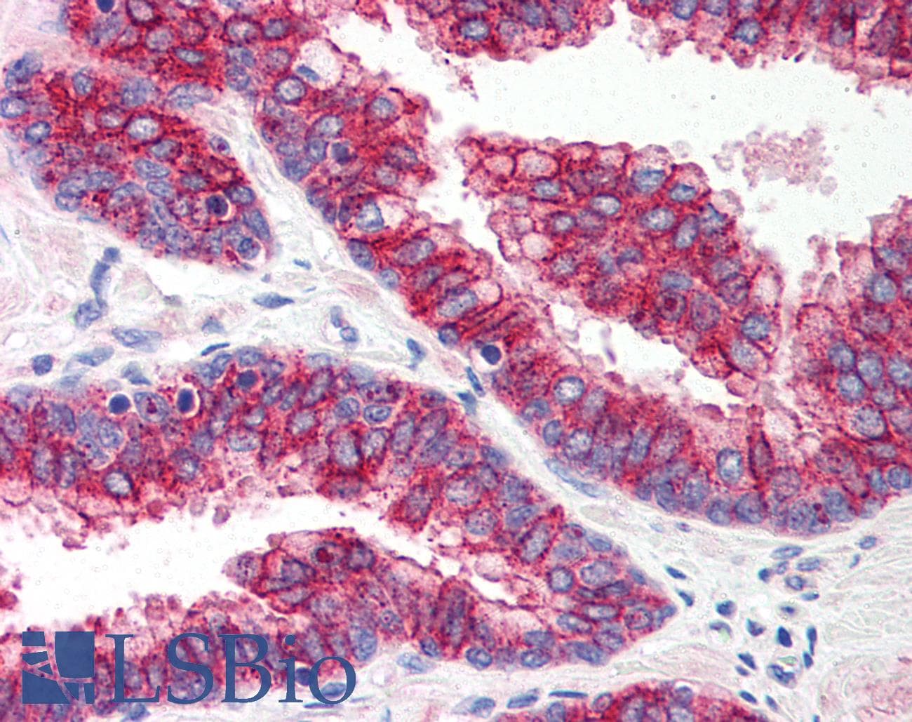 IHC-plus™ Polyclonal Rabbit anti-Human TLR5 Antibody (IHC, WB)